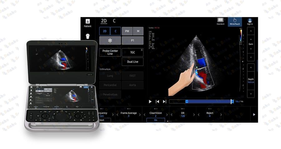 EVO Q10 - Point of Care Ultrasound System 2