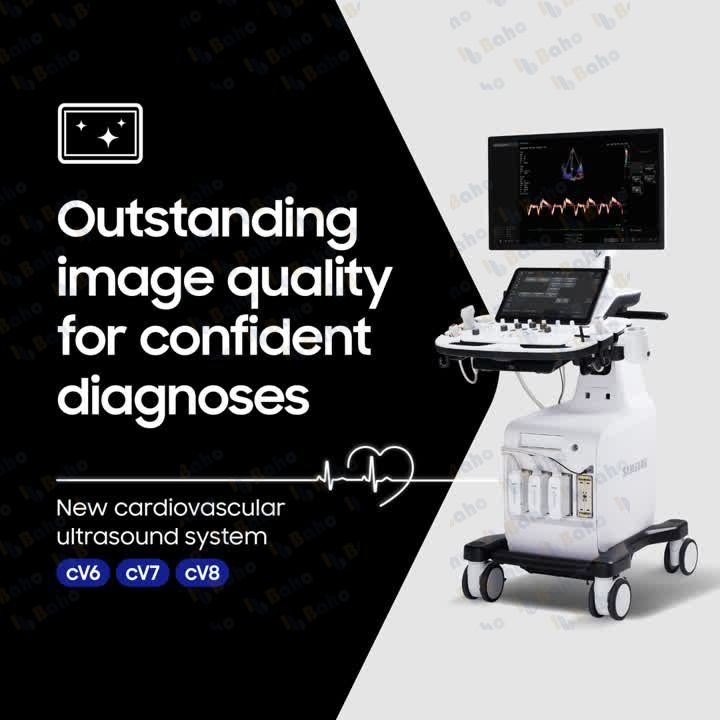 cV8 - Cardiovascular Ultrasound System 2