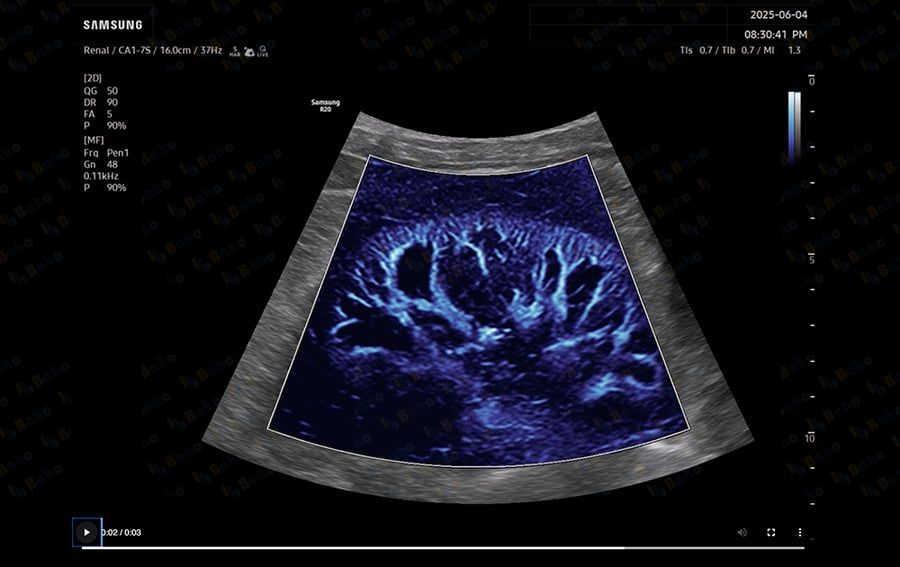 R20 - Ultrasound System 5