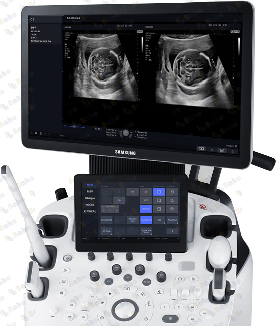 HS60 - Women's Health Ultrasound System