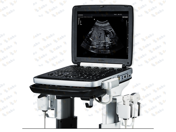 HM70 EVO - General Imaging Ultrasound System (Portable) 1