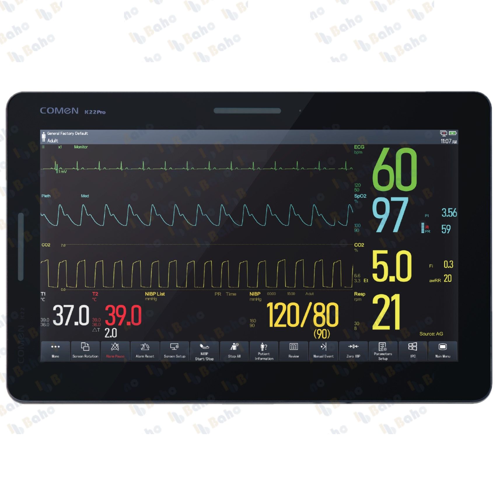 COMEN K22 Pro Patient Monitor