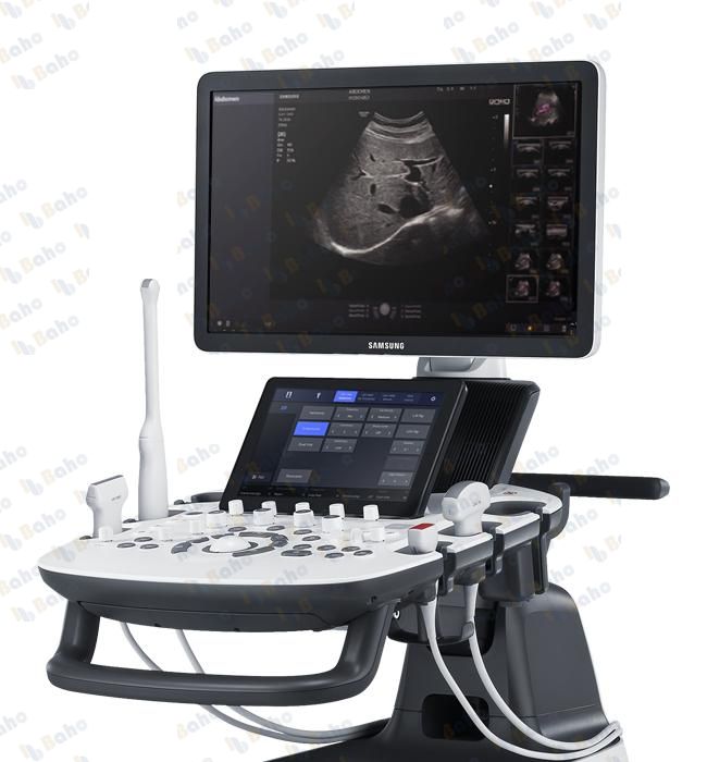 HS50 - Women's Health Ultrasound System