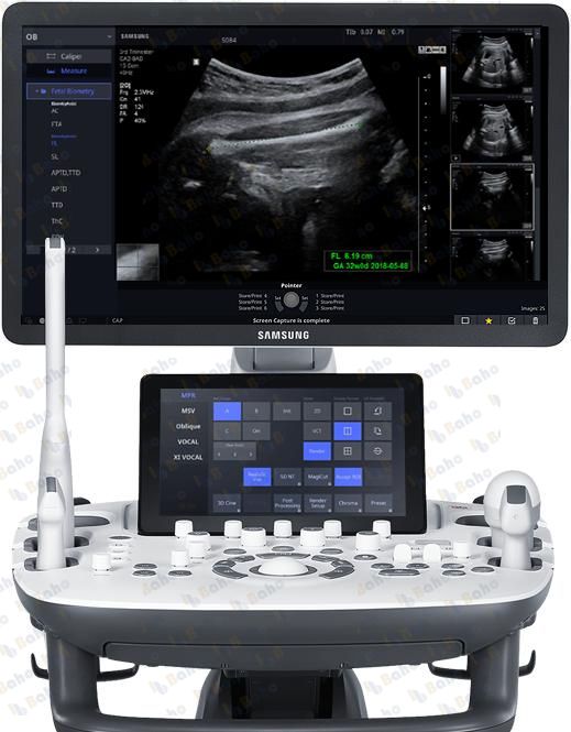 HS50 - Women's Health Ultrasound System 3