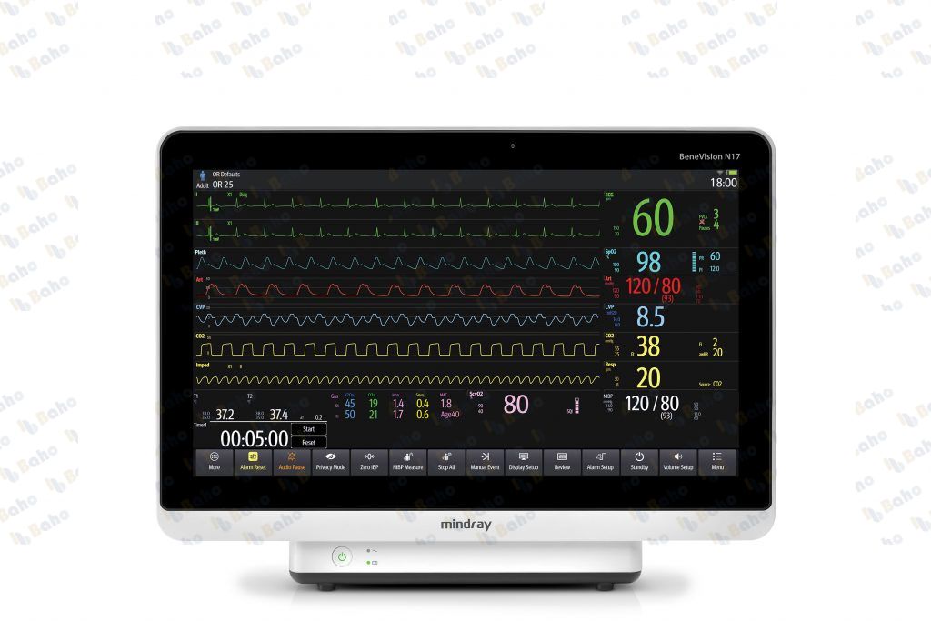 BeneVision N17 Patient Monitor