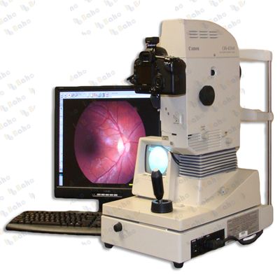 CR6-45NM Non-Mydriatic Retinal Camera