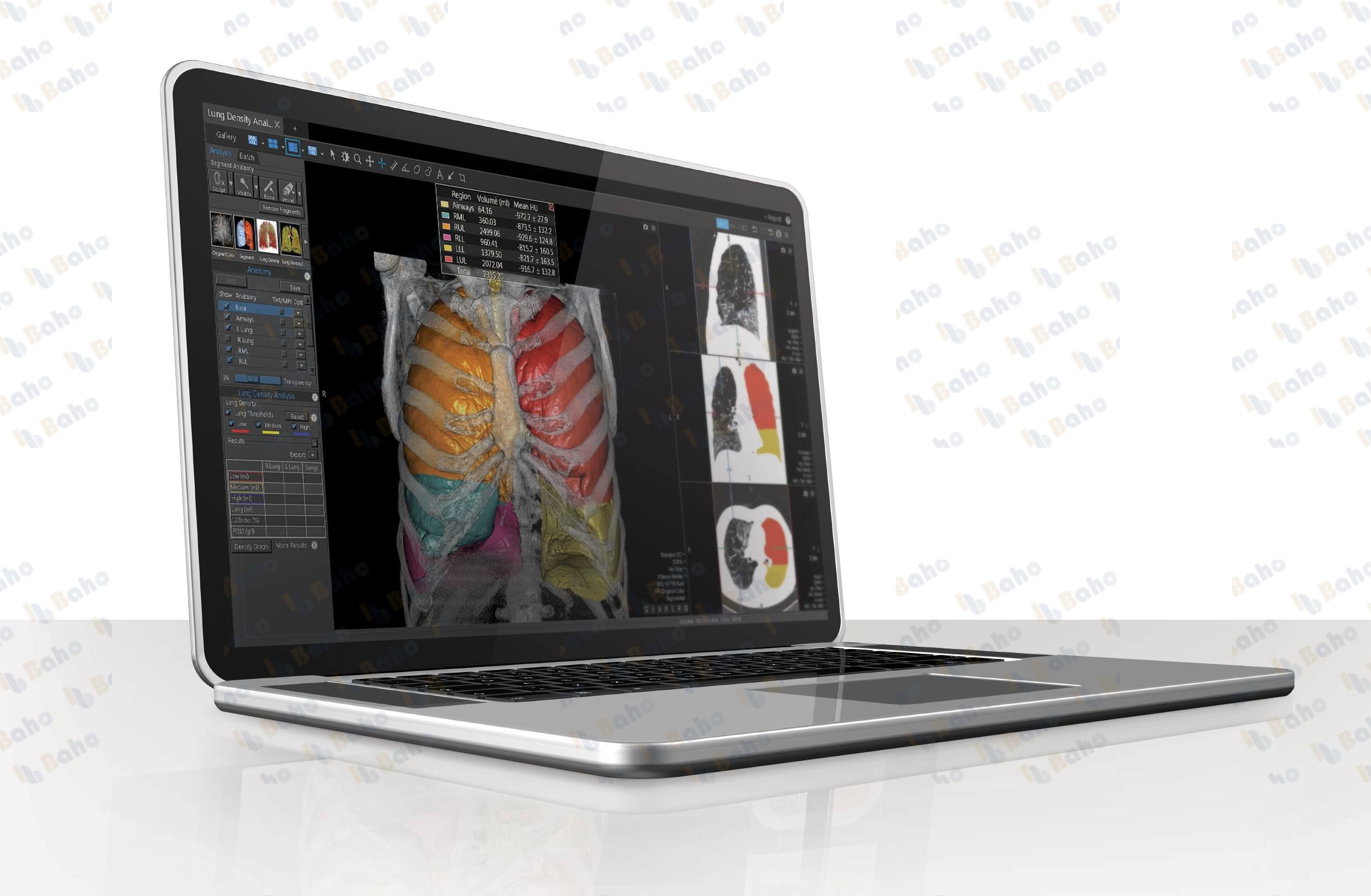EasyViz Diagnostic Viewer