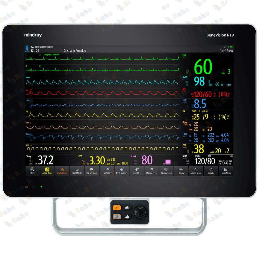 BeneVision N19 Patient Monitor