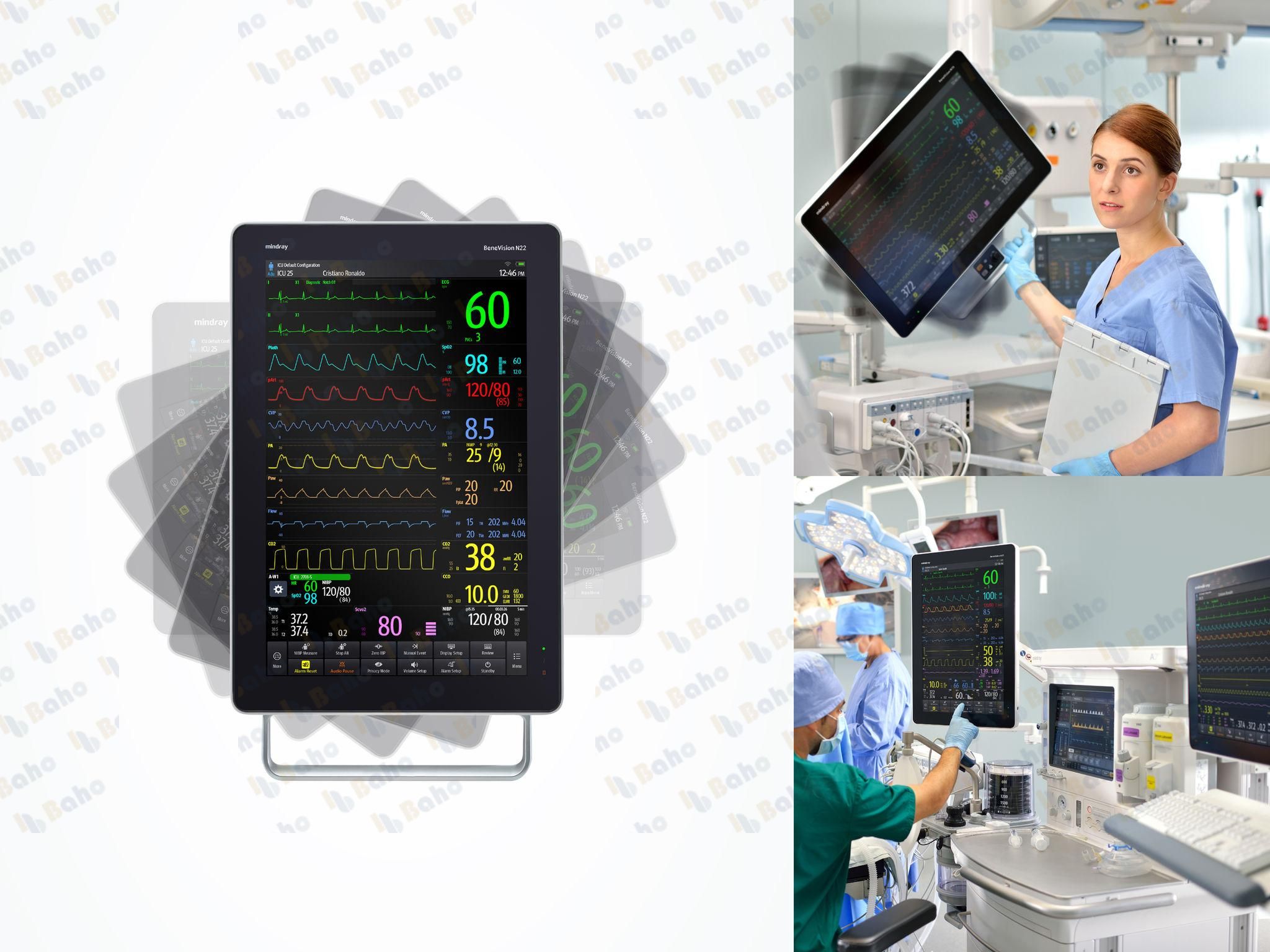 BeneVision N22 Patient Monitor 3