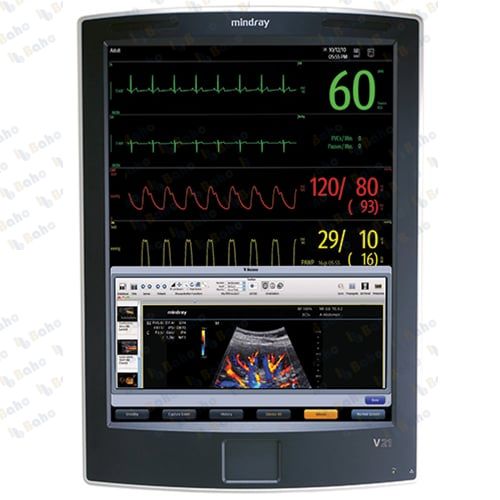 V21 Patient Monitor