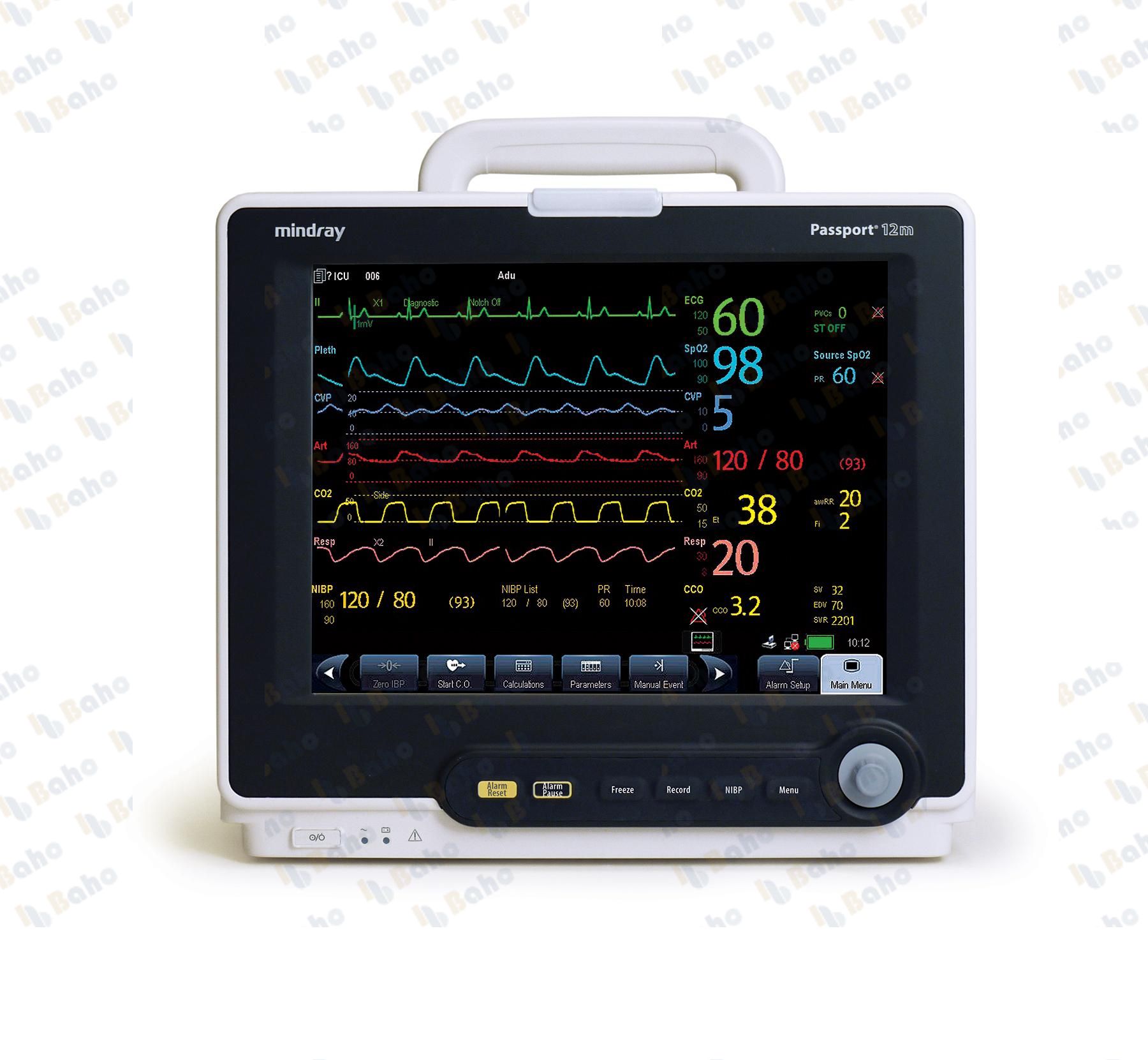 Passport 12m Patient Monitor