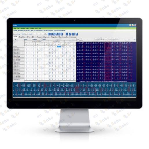 HScribe Holter Analysis System