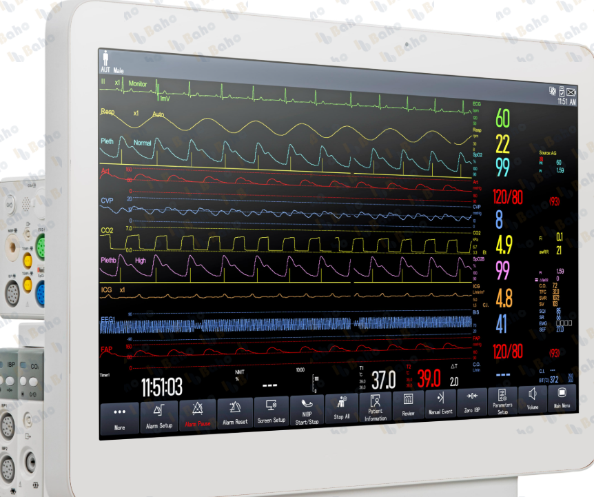 iX15 Patient Monitor
