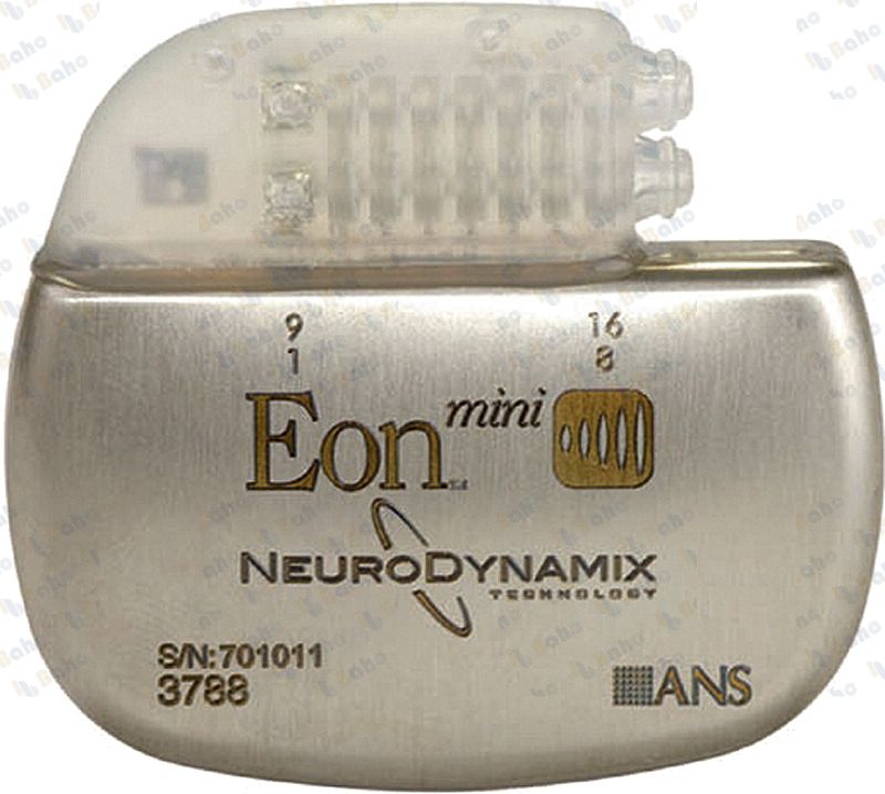 Eon Mini Implantable Pulse Generator