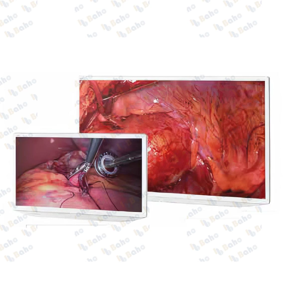Full HD and 4K Medical Grade Monitors