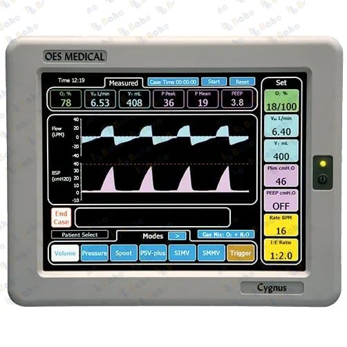 Cygnus Anaesthesia Ventilator