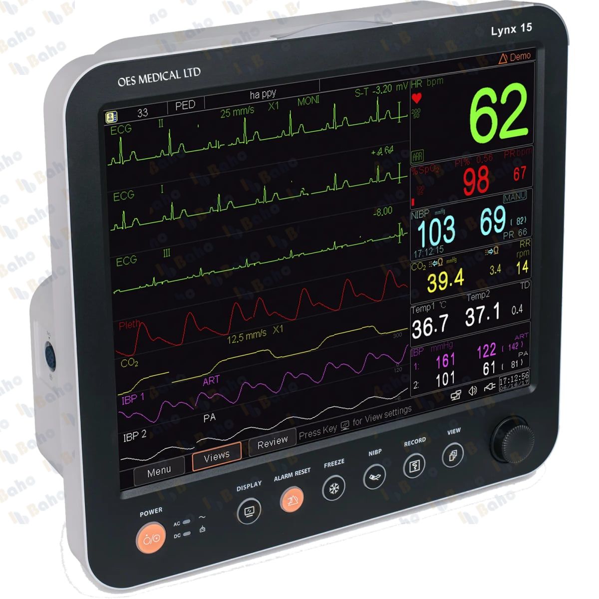 Lynx 15 Patient Monitor